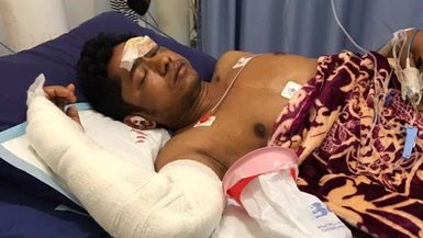 Rohingya refugee on Nauru calls for Australian medical consultation after road accident