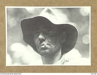 MOUNT PROTHERO AREA, NEW GUINEA. 1944-01-21. A CLOSE UP OF A MEMBER OF THE 2/12TH INFANTRY BATTALION WHO WAS WOUNDED INTHE ACTION MOUNT PROTHERO