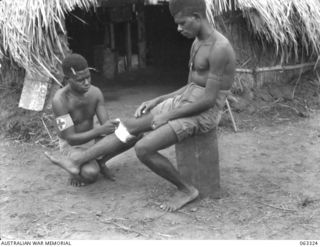 DUMPU, NEW GUINEA. 1944-01-04. A NATIVE "DOCTOR BOY" BANDAGING THE LEG OF A PATIENT AT THE AUSTRALIAN AND NEW GUINEA ADMINISTRATION UNIT NATIVE LABOUR HOSPITAL