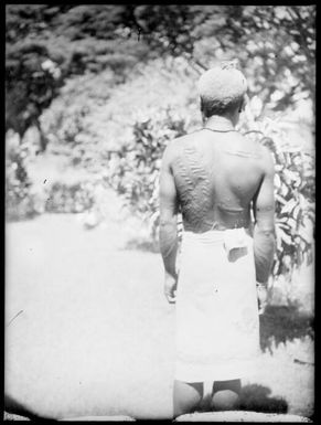 Man displaying cicatrice scars on his back, New Guinea, ca. 1929 / Sarah Chinnery