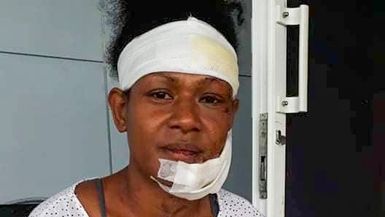 PNG sports star beaten by hot iron puts domestic violence in spotlight