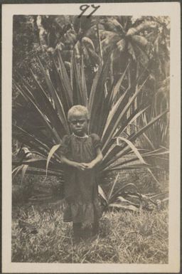 Small female child rescued by Missionary, New Britain Island, Papua New Guinea, probably 1916