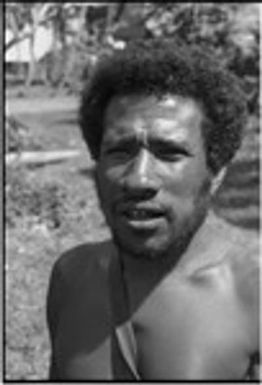 Man with betel nut stains on teeth