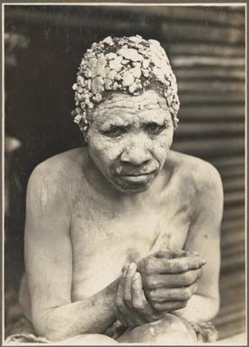 Widows, Ambasi, North Coast [close up of a woman covered in clay with one hand resting in the other] Frank Hurley